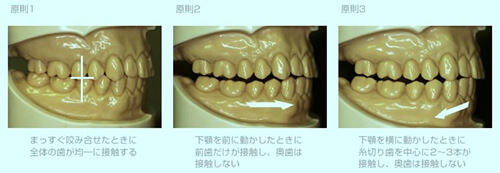 板橋ステーション歯科の噛み合わせ