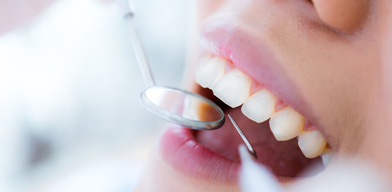 板橋ステーション歯科の予防歯科