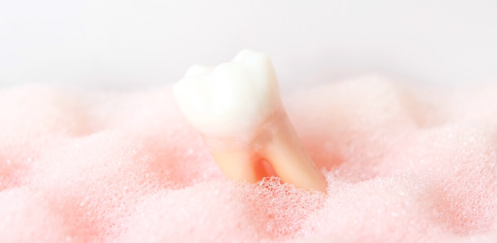 板橋ステーション歯科の歯周病治療