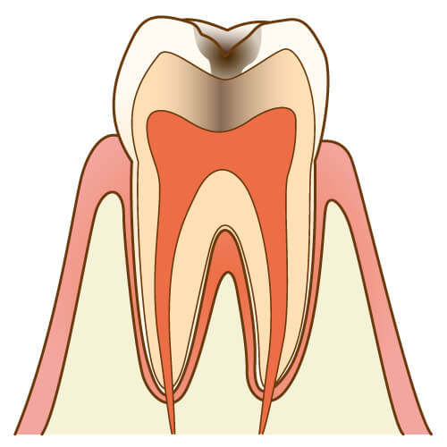 板橋ステーション歯科の歯周病治療