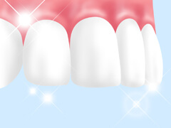 板橋ステーション歯科のホワイトニング